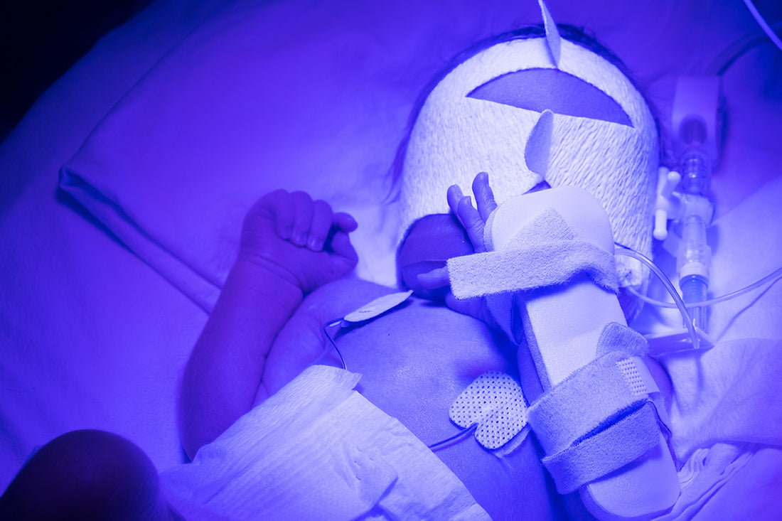 Jaundice in premature babies; what families need to know