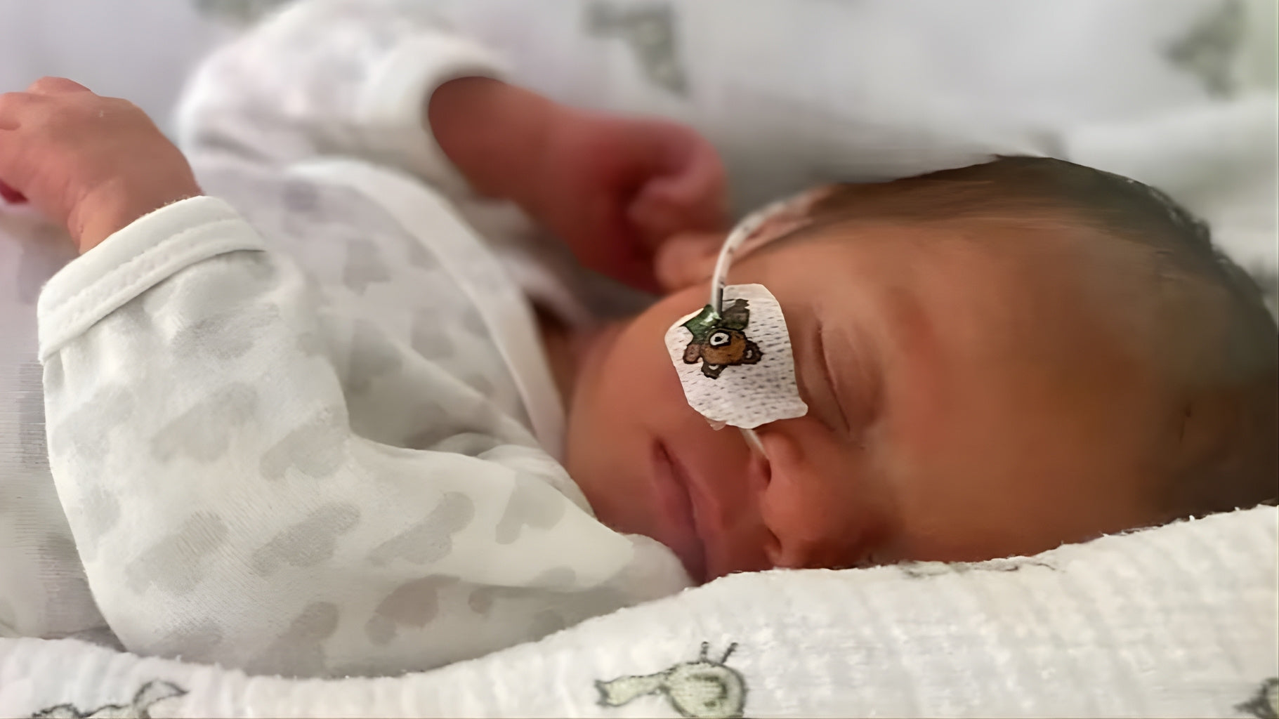 Newborn baby sleeping with a bandage on its head, wearing a white onesie.