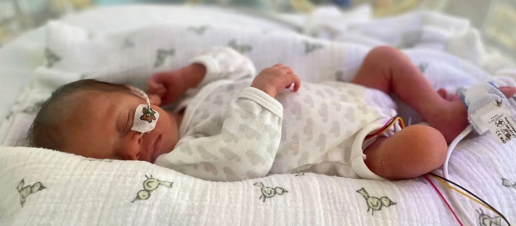 NICU baby lying on a white blanket with medical sensors attached