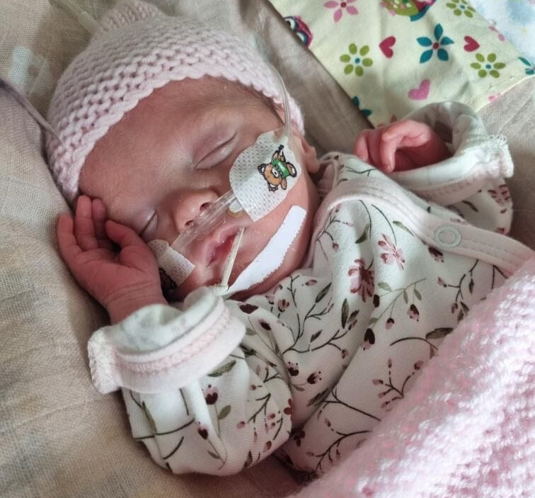Newborn baby sleeping with medical equipment on, wearing a pink hat and floral outfit.