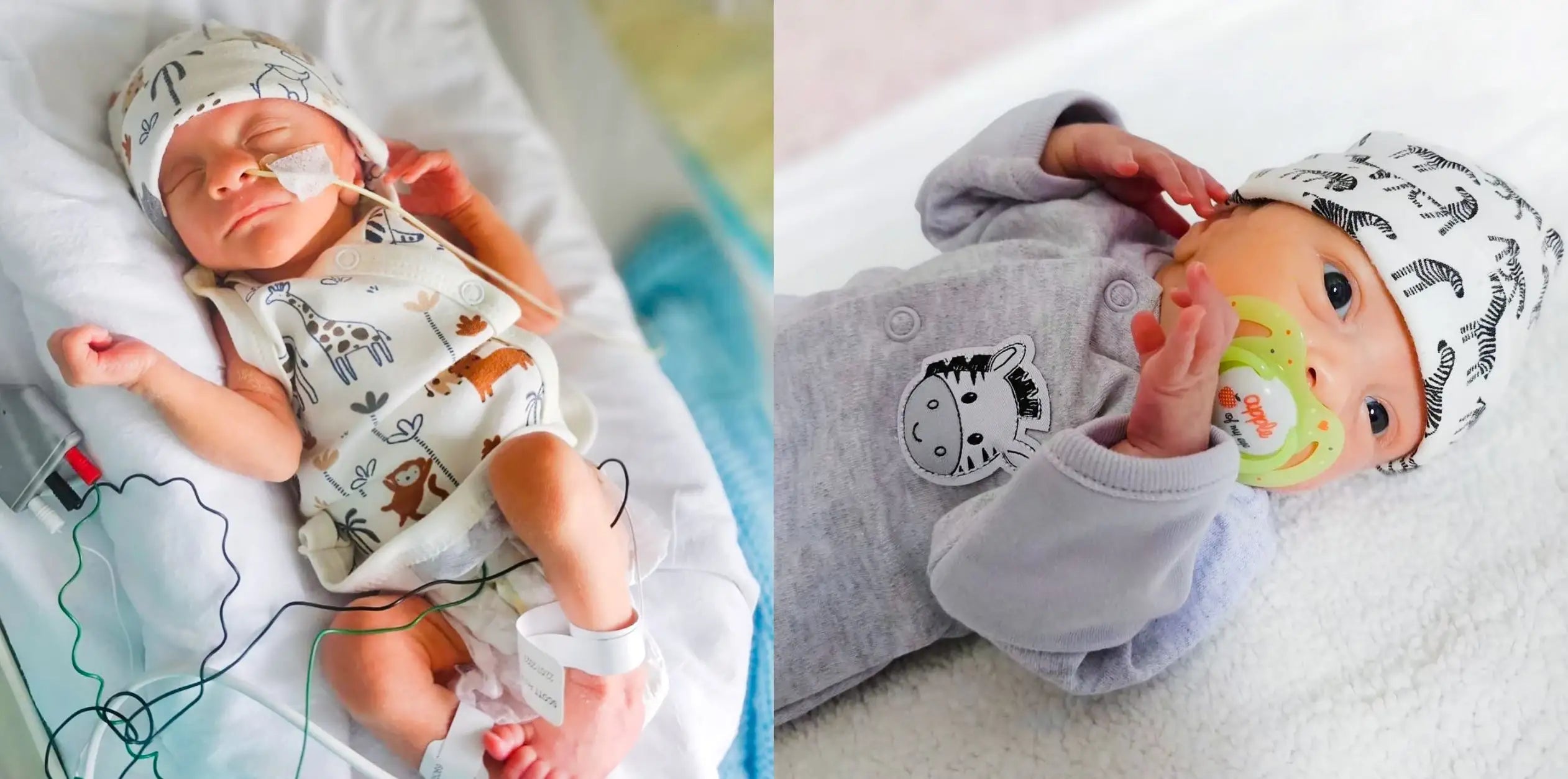 Two images of a baby in hospital and at home, wearing tiny baby size outfits with animal patterns.