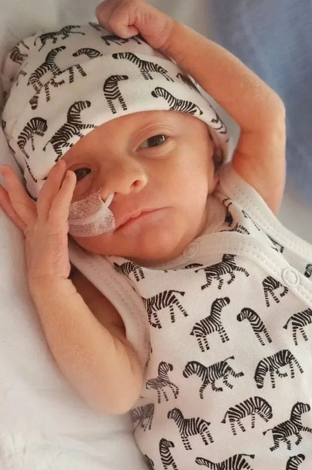 Premature Baby wearing a zebra-patterned outfit and hat on a soft surface